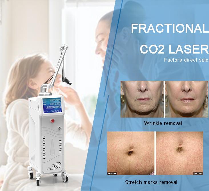 Latest medical 40W RF Tube fractional co2 laser with CE certification 3