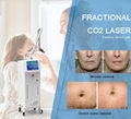Latest medical 40W RF Tube fractional co2 laser with CE certification 3