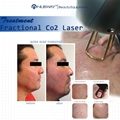 Latest medical 40W RF Tube fractional co2 laser with CE certification 4