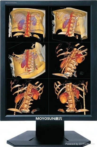 魔言2MP彩色醫療顯示器 5