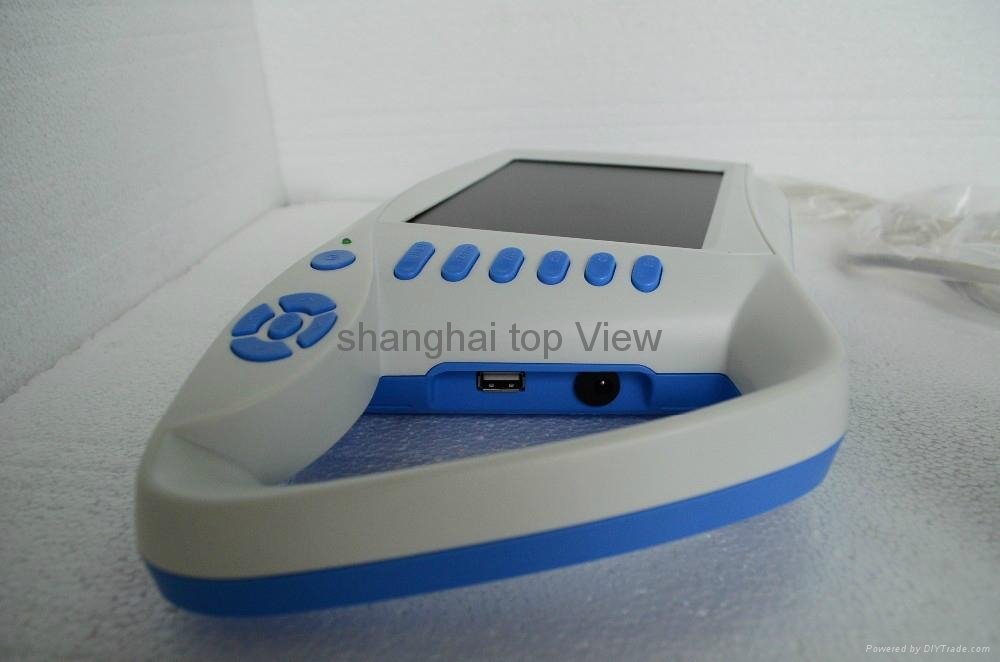 vet, animal handheld protable ATNL51353C Ultrasonic vet ultrasound scanner