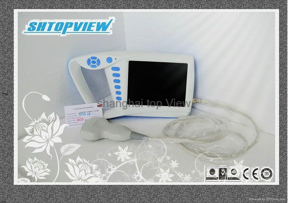 vet, animal handheld protable ATNL51353C Ultrasonic vet ultrasound scanner 5