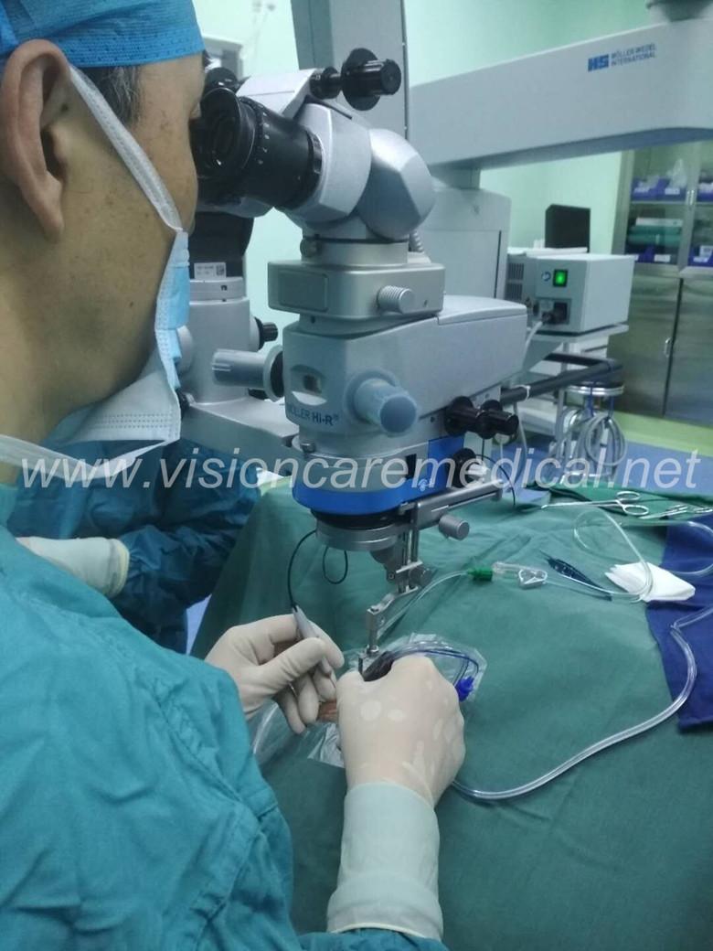 Ophthalmic Surgical Microscope MegaVue System for Zeiss Leica Topcon Microscope 5