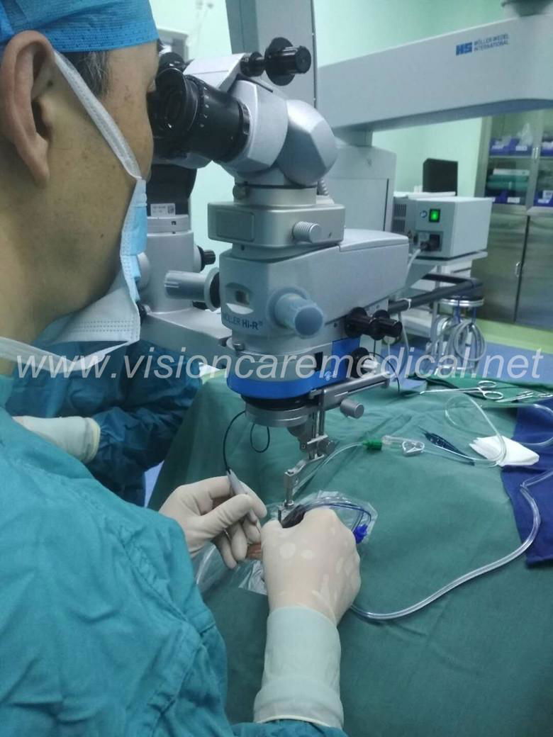 Ophthalmic Surgical Microscope MegaVue for Zeiss Leica Moller Topcon Microscope 5