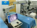 Ophthalmic Surgical Microscope for Anterior Surgery & Retinal Vitreous Surgery 3