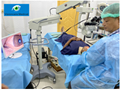Ophthalmic Surgical Microscope for Anterior Surgery & Retinal Vitreous Surgery