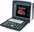 FULL DIGITAL COLOR DOPPLER DIAGNOSTICL