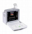 FULL DIGITAL COLOR DOPPLER DIAGNOSTICL SYSTEM 1