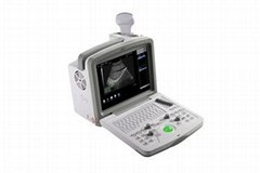 Full Digital Ultrasound Diagnostic System