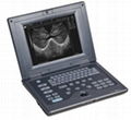 Laptop Full Digital Ultrasound Diagnostic System 1