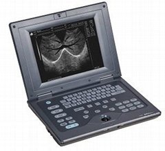 Laptop Full Digital Ultrasound Diagnostic System