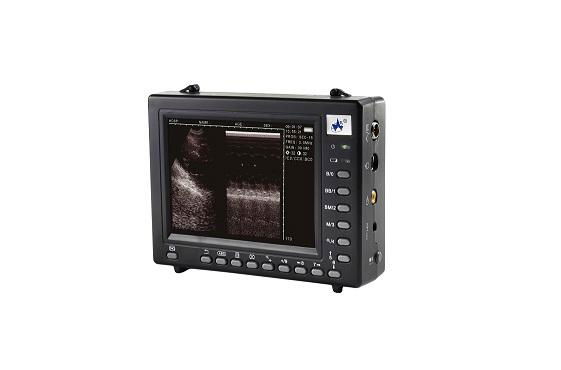 Palmsize Full Digital Ultrasound Diagnostic System