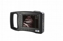 Palmsize Full Digital Ultrasound Diagnostic System