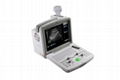 Digital Ultrasound Scanner