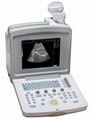 Digital Ultrasound Scanner