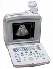 Digital Ultrasound Scanner