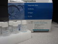 Hepcidin-25 ELISA Kit