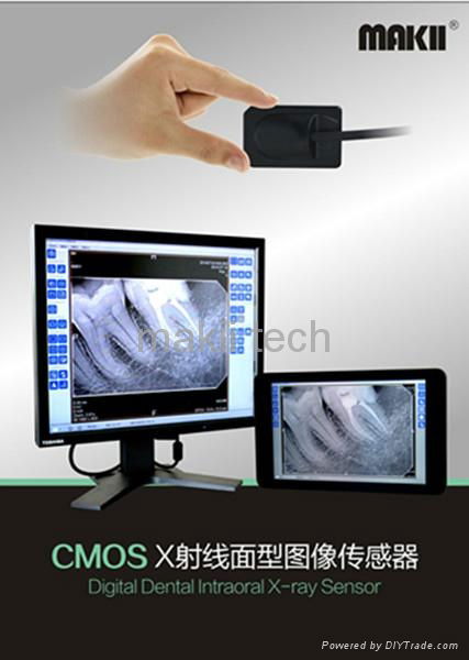 Digital Dental Intraoral X-ray Sensor 4