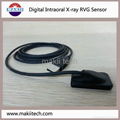 Digital Dental Intraoral X-ray Sensor 2