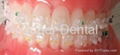 Orthodontic Ceramic translucent Bracket ROTH MBT 1