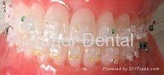 Orthodontic Ceramic translucent Bracket ROTH MBT