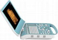 Color Doppler Ultrasound Imaging System