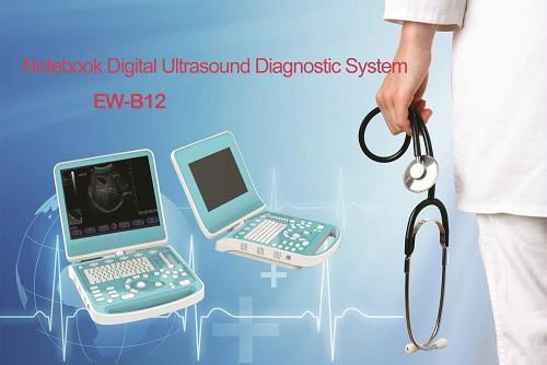 Digital Ultrasonic Diagnostic Imaging System EW-B12 2