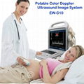 Color Doppler Ultrasound Imaging System