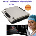Color Doppler Ultrasound Imaging System