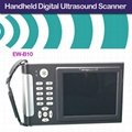 Digital Ultrasound Diagnostic System