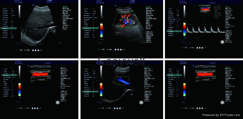 Portable Color Veterinary Ultrasound images EW-C8V with Micro-Convex probe C3.5R 4