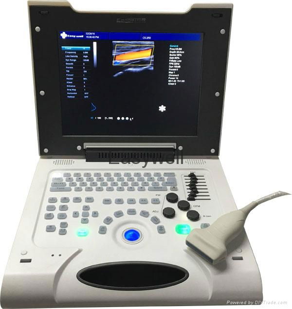 Affordable Color Veterinary Ultrasound System EW-C8V with Linear probe L7L40  3