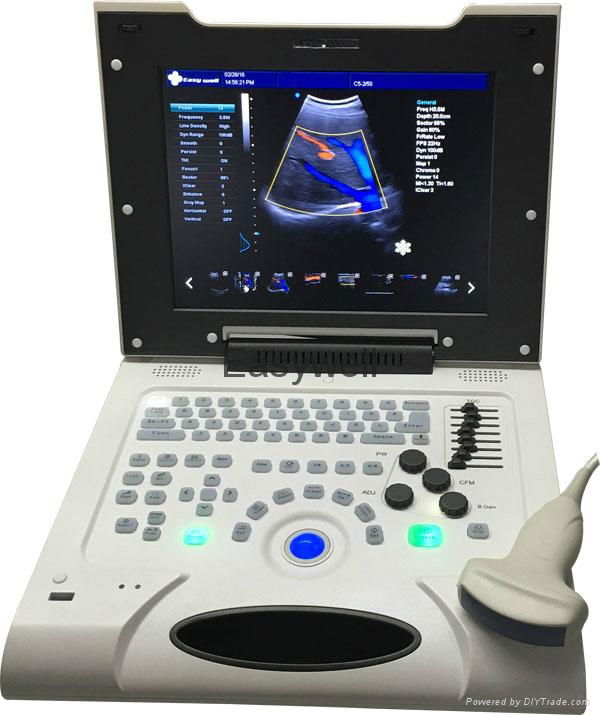  Laptop Veterinary Ultrasound Scanner Color Doppler Ew-C8V with Convex Probe  2