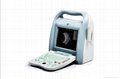 ophthalmic ultrasound scanner ODU8 2