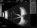 ophthalmic ultrasound scanner ODU8