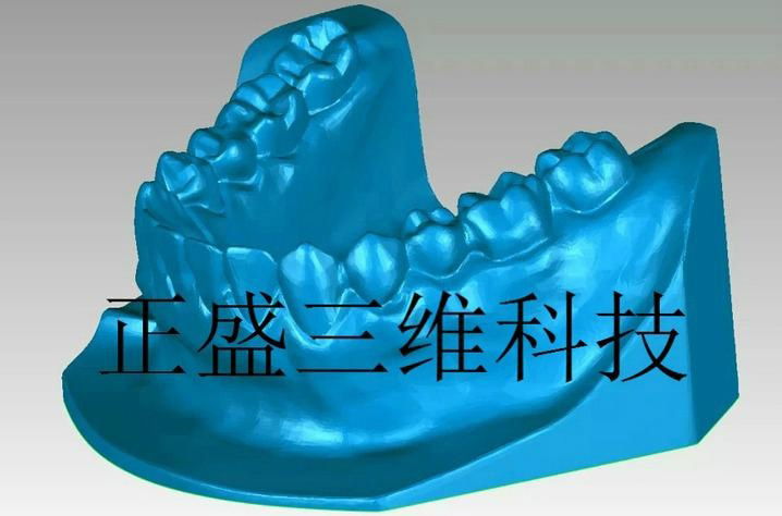 五金牙模3D掃描儀 4