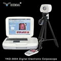 ykd-3003  Portable Digital Colposcope with Camera for Clinic