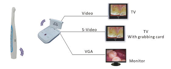 TOYE Wireless Dental Intra oral Camera  2