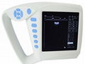 ATNL51353C Digital Palm Ultrasound Scanner 