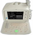 ATNL51353A Digital Portable Ultrasound