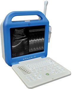 ATNL51353A Digital Laptop Ultrasound Scanner 
