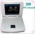 ATNL200 Full Digital notebook Ultrasound Scanner 