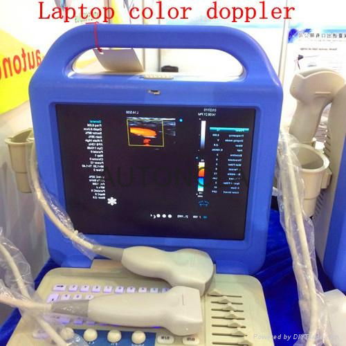 ATNL/6801  Full-digital Laptop Color Doppler  2