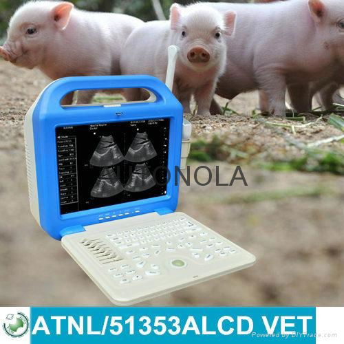 ATNL51353A-LCD VET Digital Laptop Ultrasound Scanner  3