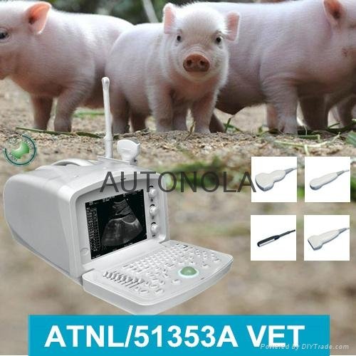 ATNL51353A VET Digital Portable Ultrasound Scanner  3