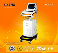 Hifu RUV89 Italy technology wrinkle removal & face lifting hifu machine with ce 