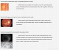 Optical equipmentsTNF507 Fundus Camera with FFA function 4