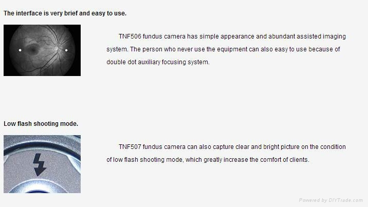 Optical equipmentsTNF506 Fundus Camera  5