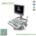 Color Doppler Trolley ultrasonic