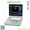 2016 portable color doppler ultrasound MSLCU31 for sale 1